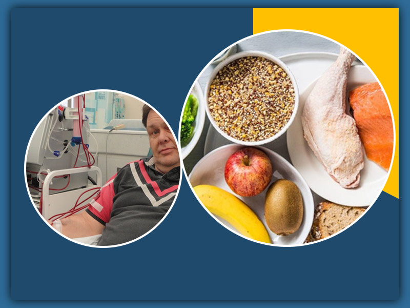 Renal Diet: Know 7 Foods That Could Help You During Dialysis